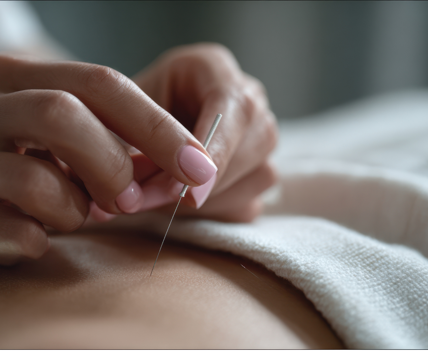 single needle acupuncture therapy