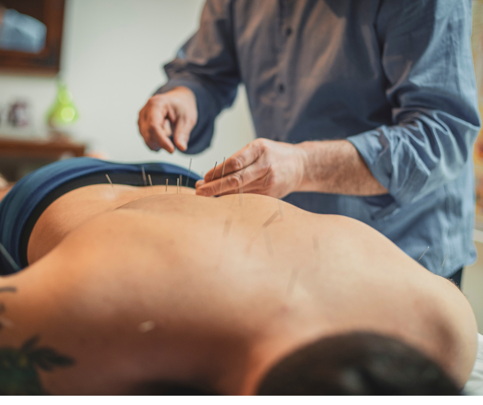 clinical acupuncture therapy