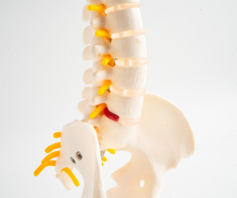 slip disc physiotherapy