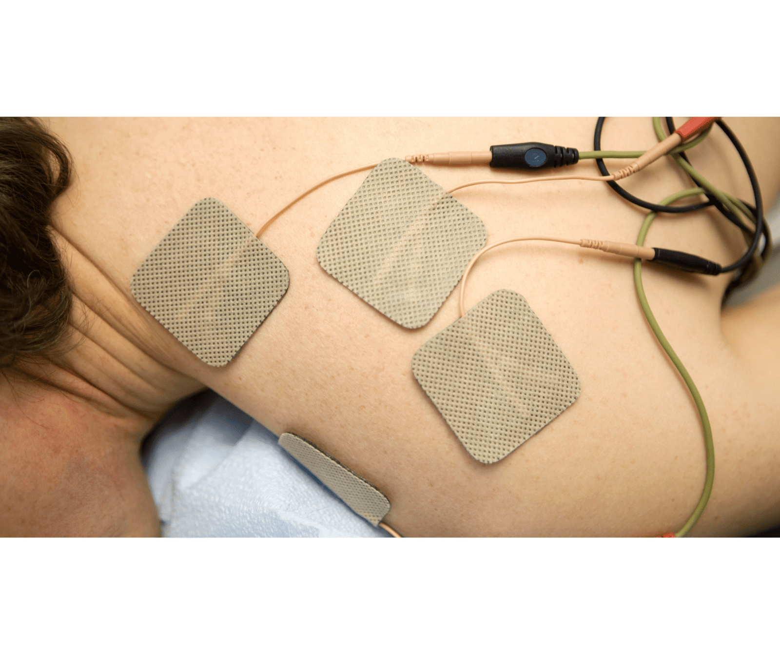 frozen shoulder treatment