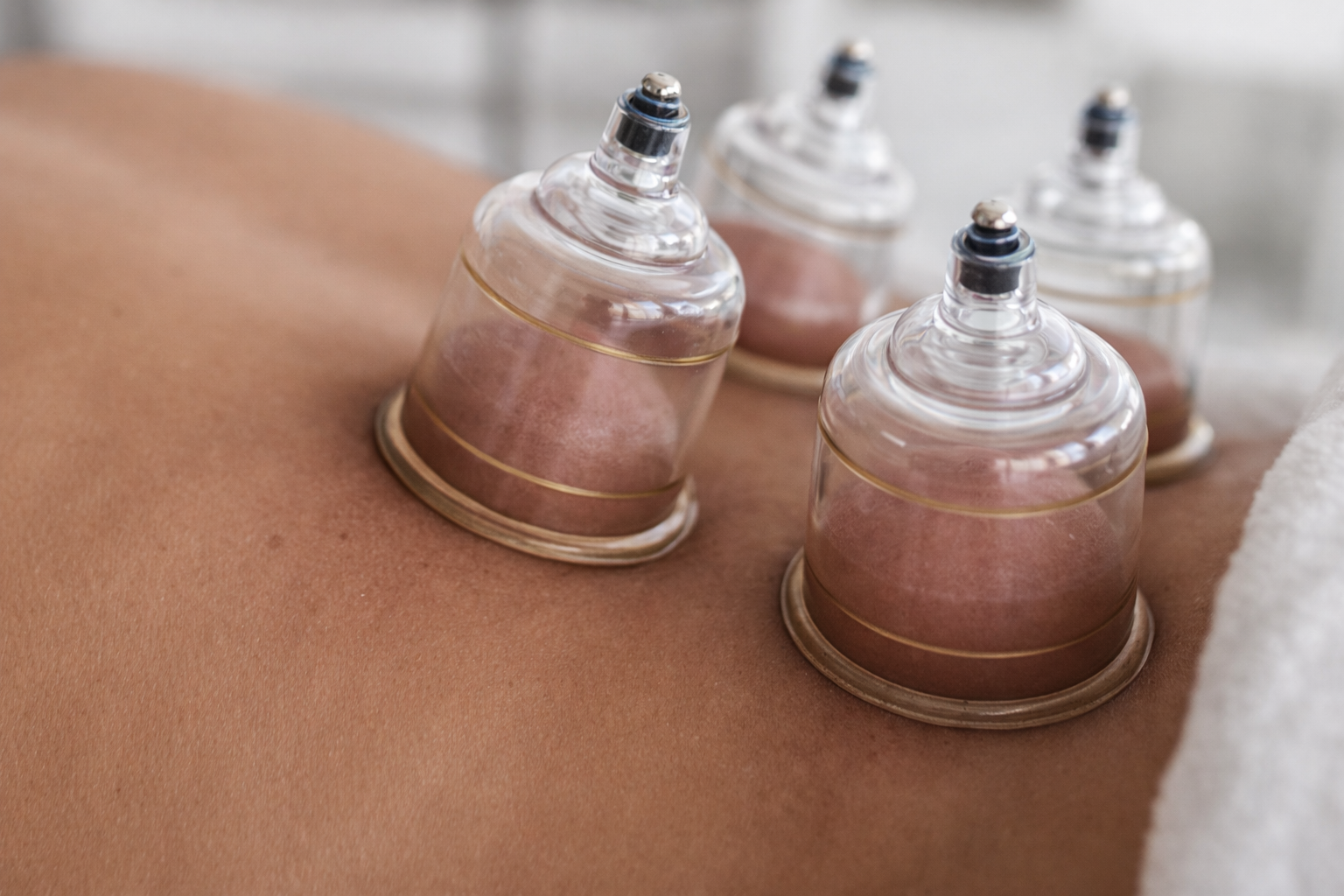 dry cupping therapy