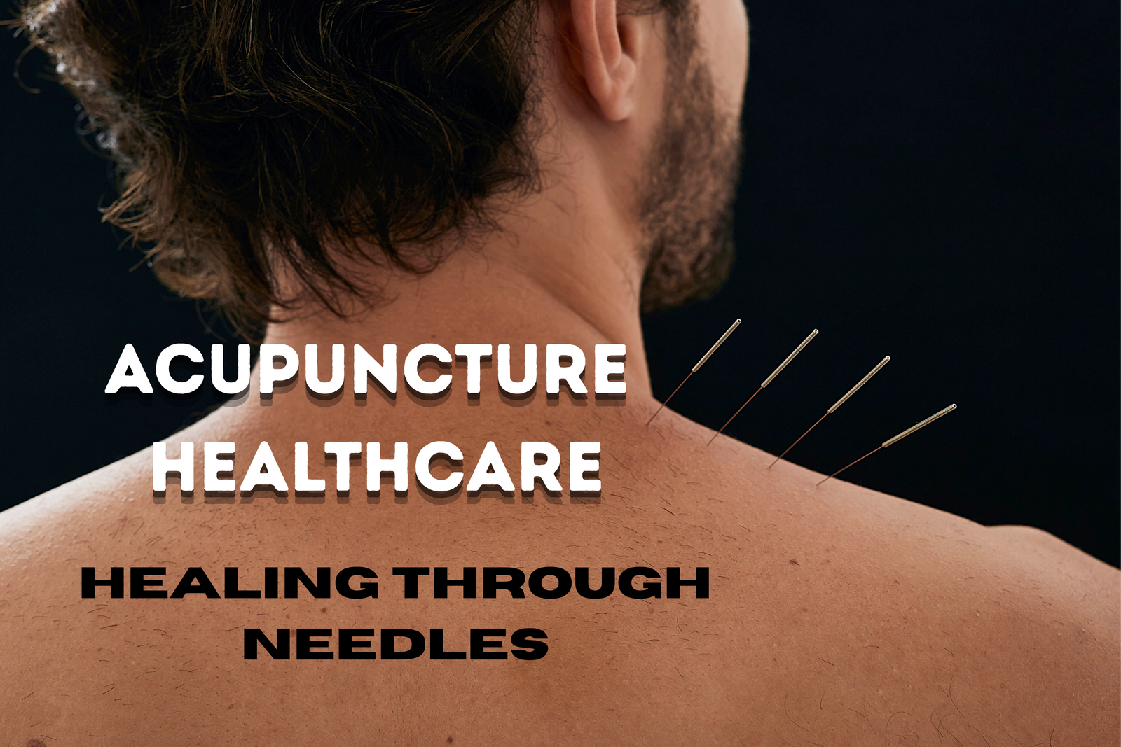 acupuncture healthcare