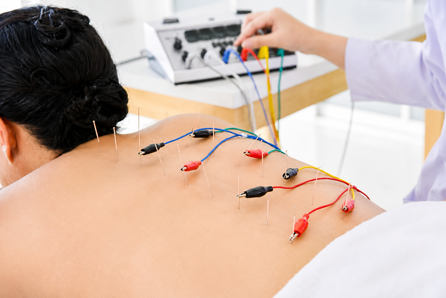 Electro Acupuncture